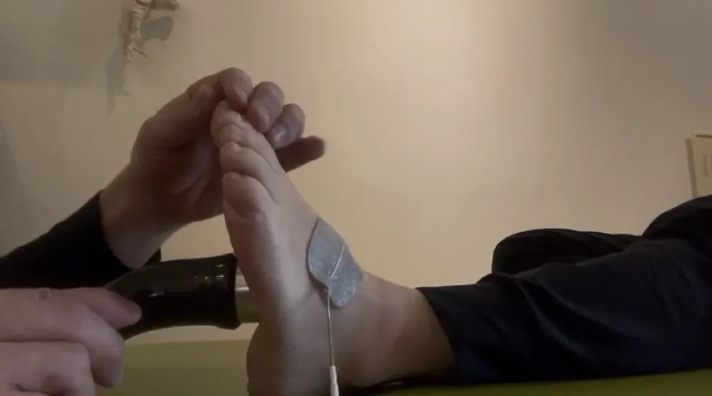 足底腱膜炎の超音波治療