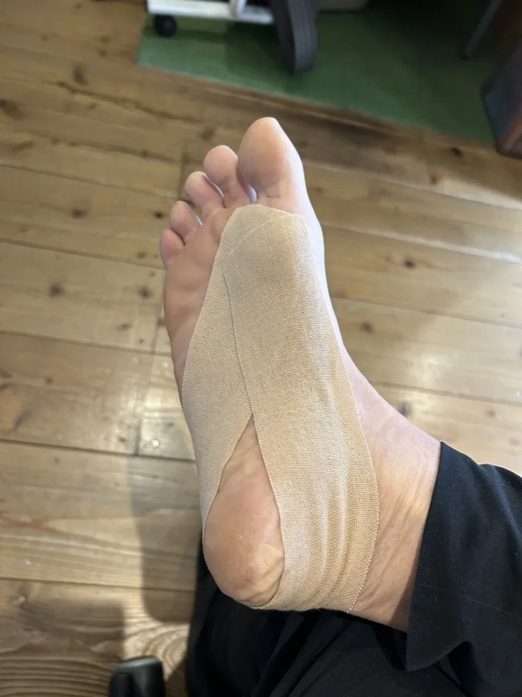 足底腱膜炎のテーピング